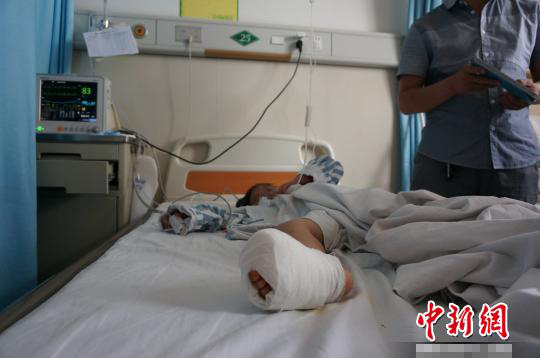 5月20日,女孩在湖北宜昌市第一人民医院成功接受了右脚大拇指去除手术
