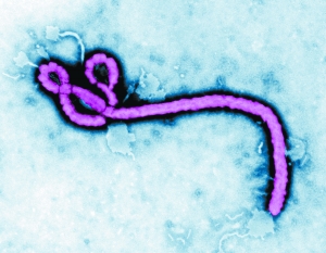 我国科学家分离出埃博拉抗体 未来或可救治感染者