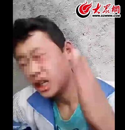 臨沂一男生被扇耳光上百次 打人者為“00後”曾因吸毒盜竊被多次處理