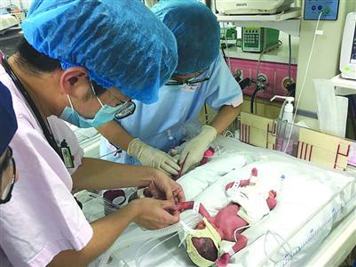 同卵四胞胎降生 母亲怀孕29周住进医院（组图）