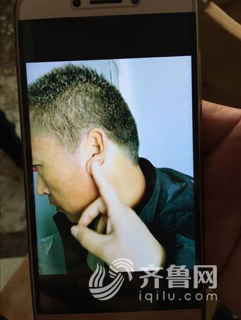 一名傷者耳朵被飛出的玻璃劃傷-記者-王舒薇-攝